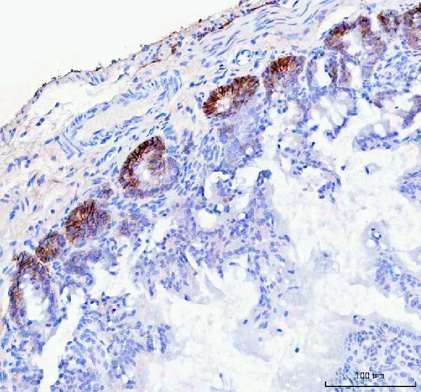pa2169 slc12a2 primary antibodies ihc testing 4