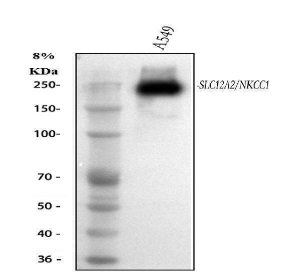 pa2169 slc12a2 primary antibodies wb testing 1