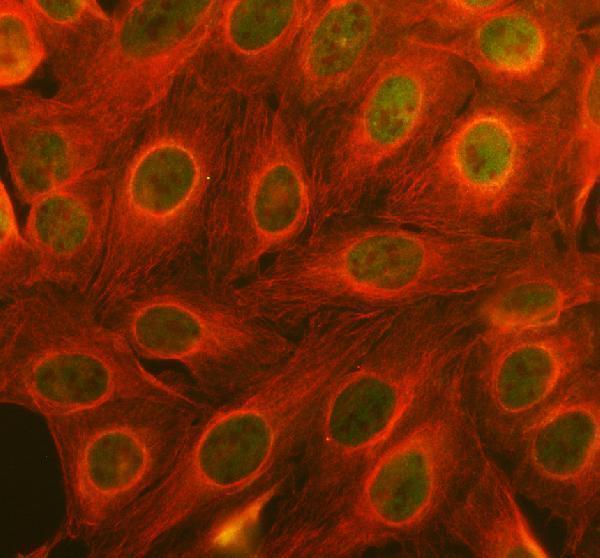 pa2178 egr2 primary antibodies if testing 1