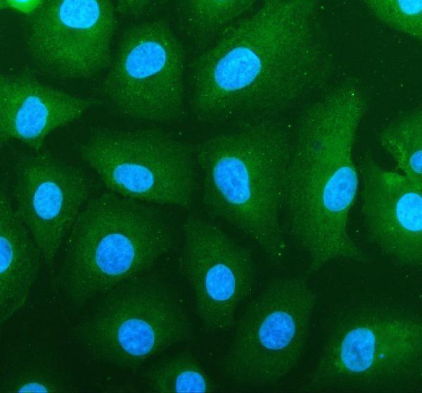 pa2189 slc16a4 primary antibodies if testing 1