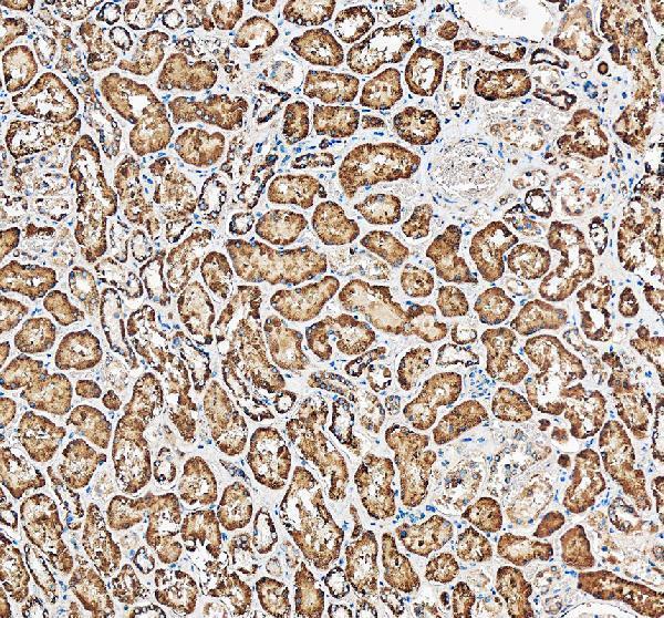 pa2189 slc16a4 primary antibodies ihc testing 1