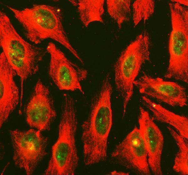 pa2209 irf8 primary antibodies if testing 1