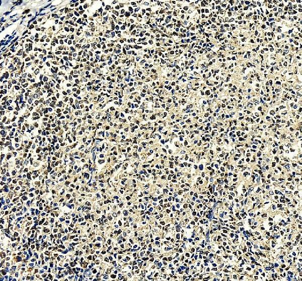pa2209 irf8 primary antibodies ihc testing 1