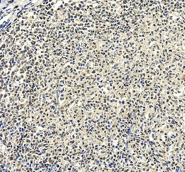 pa2209 irf8 primary antibodies ihc testing 3