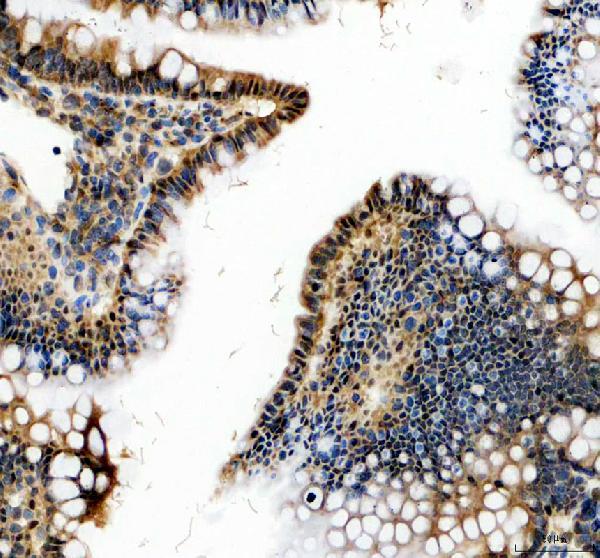 pa2211 prkdc primary antibodies ihc testing 3