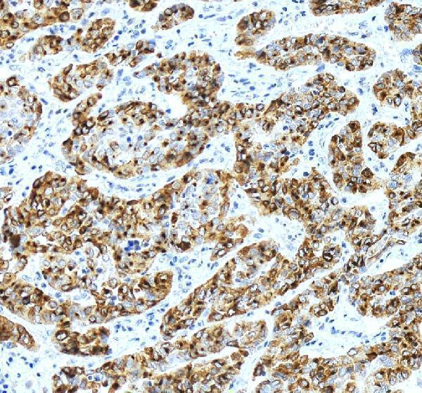 pa2217 serpina3 primary antibodies ihc testing 3