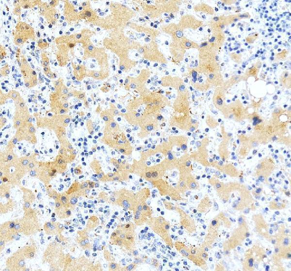 pa2217 serpina3 primary antibodies ihc testing 4