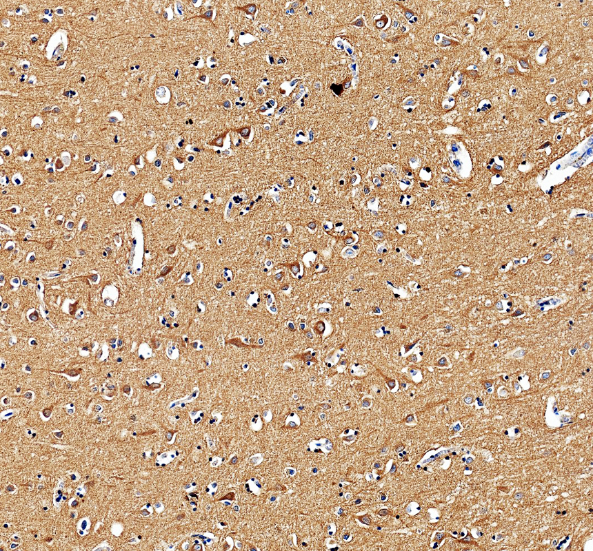 pa2256 rtn3 primary antibodies ihc testing 1