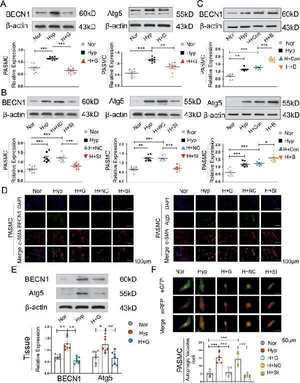 pa2260 41419_2020_2930_fig2_html