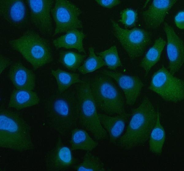 pa2260 atg5 primary antibodies if testing 1