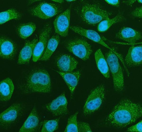  IF analysis of PRMT4/CARM1 using anti-PRMT4/CARM1 antibody (PA2263)