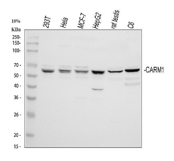  Western blot analysis of PRMT4/CARM1 using anti-PRMT4/CARM1 antibody (PA2263)