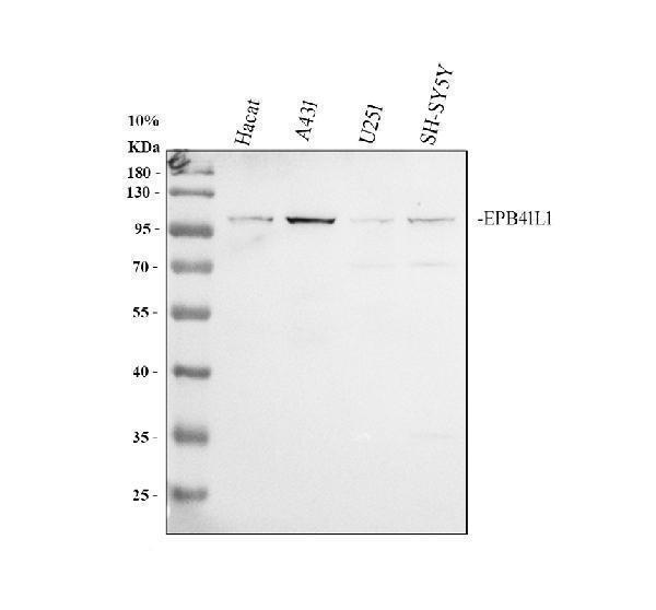 Western blot analysis of EPB41L1 using anti-EPB41L1 antibody (PA2266)