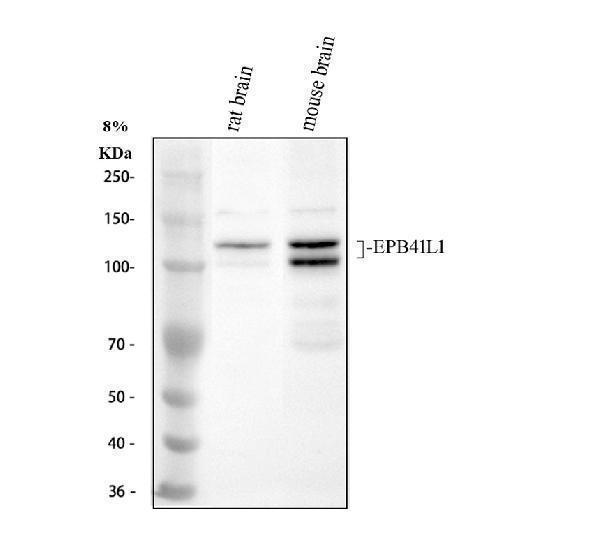 Western blot analysis of EPB41L1 using anti-EPB41L1 antibody (PA2266)