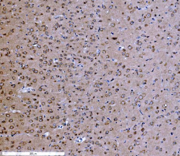  IHC analysis of PSD95/DLG4 using anti-PSD95/DLG4 antibody (PA2295)