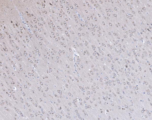 pa2295 dlg4 primary antibodies ihc testing 3
