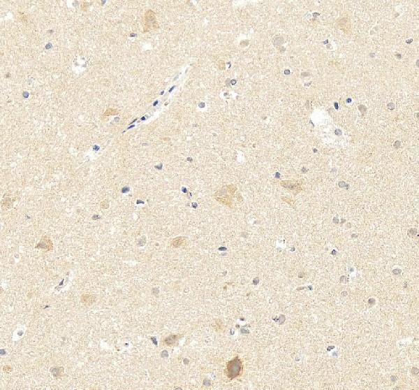 IHC analysis of PSD95/DLG4 using anti-PSD95/DLG4 antibody (PA2295)