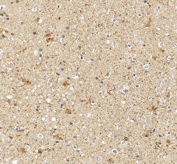 IHC analysis of DDAH1 using anti-DDAH1 antibody (PB10000)