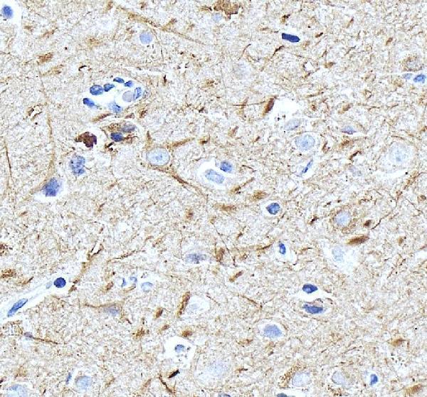 IHC analysis of Alpha Internexin/INA using anti-Alpha Internexin/INA antibody (PB10003)