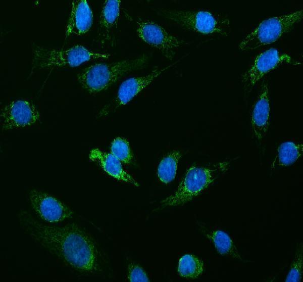 pb10006 tak1 primary antibodies if testing 1