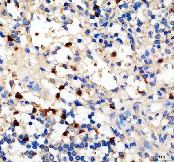 pb10011 pf4 primary antibodies ihc testing 1
