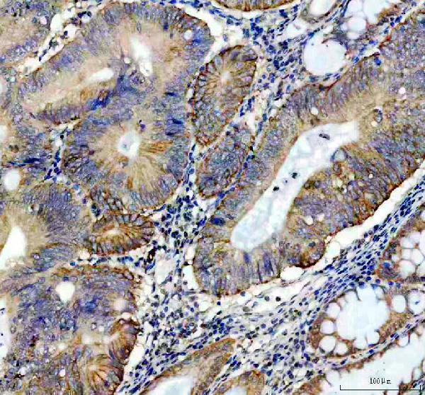 pb10013 plin3 primary antibodies ihc testing 1