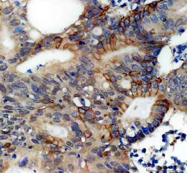pb10013 plin3 primary antibodies ihc testing 2