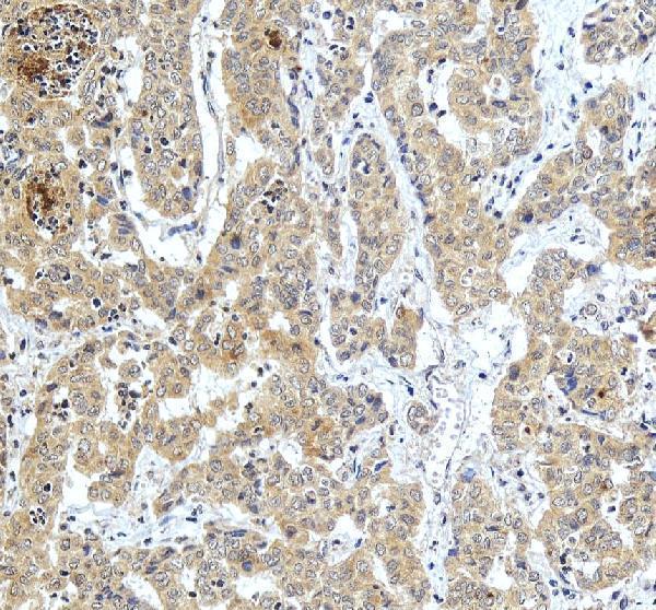 IHC analysis of ZWINT using anti-ZWINT antibody (PB10018)