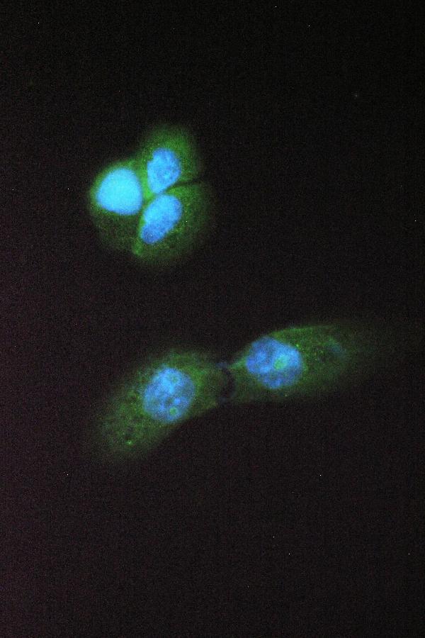 Figure 3. IF analysis of Abhd5 using anti-Abhd5 antibody (PB10021). Abhd5 was detected in immunocytochemical section of A431 cell. Enzyme antigen retrieval was performed using IHC enzyme antigen retrieval reagent (AR0022) for 15 mins. The cells were blocked with 10% goat serum. And then incubated with 2microg/mL rabbit anti-Abhd5 Antibody ((PB10021) overnight at 4°C. DyLight®488 Conjugated Goat Anti-Rabbit IgG (BA1127) was used as secondary antibody at 1:100 dilution and incubated for 30 minutes at 37°C. The section was counterstained with DAPI. Visualize using a fluorescence microscope and filter sets appropriate for the label used.