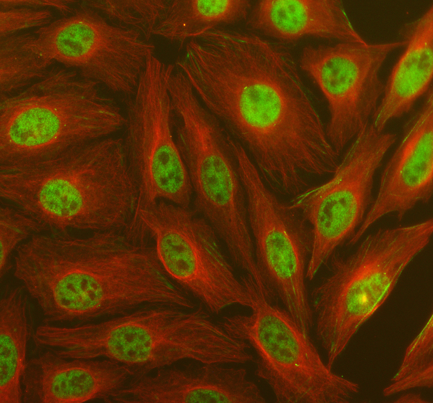 pb10021 abhd5 primary antibodies if testing 1