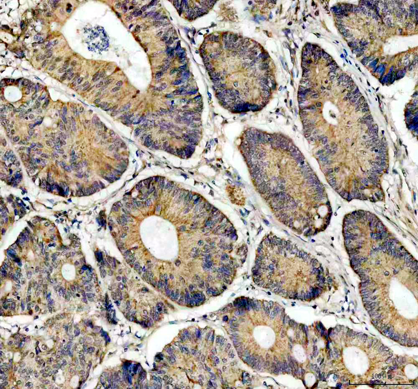 pb10021 abhd5 primary antibodies ihc testing 1