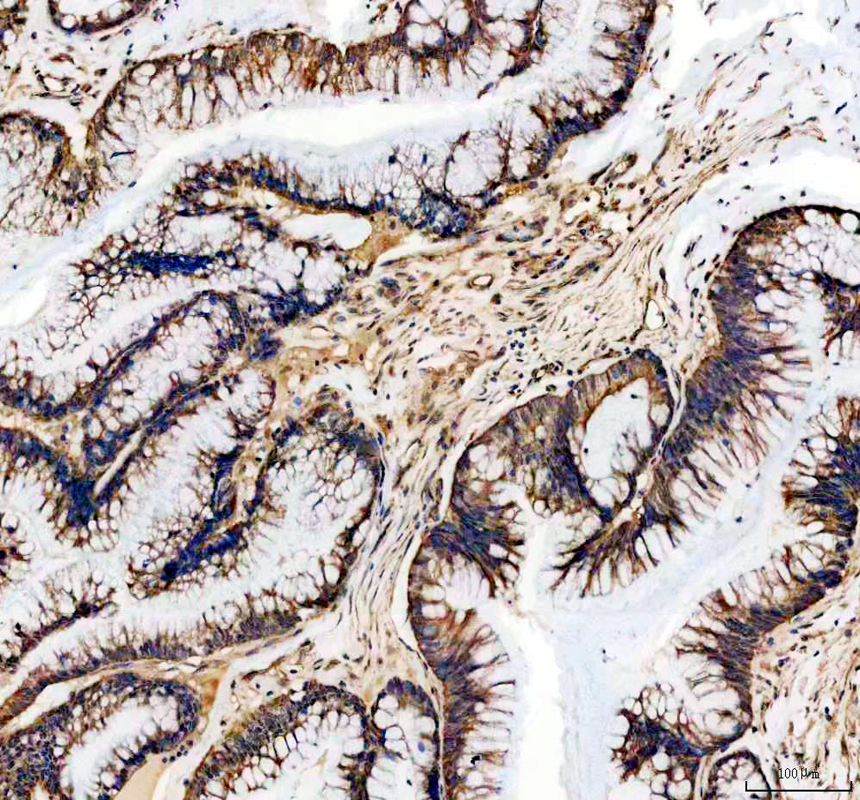 pb10021 abhd5 primary antibodies ihc testing 2