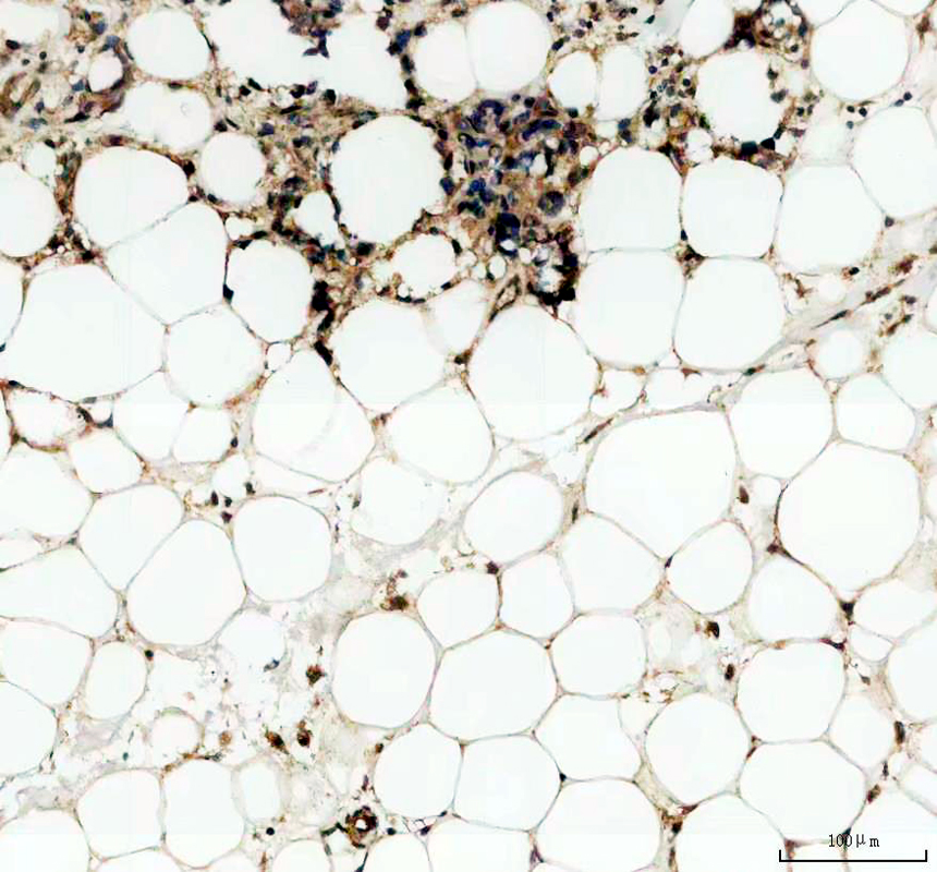 pb10021 abhd5 primary antibodies ihc testing 3