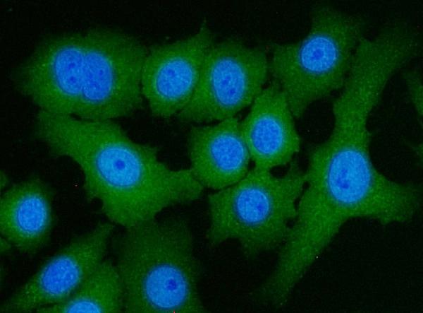 Figure 9. IF analysis of ACLY using anti-ACLY antibody (PB10024). ACLY was detected in an immunocytochemical section of A594 cells. Enzyme antigen retrieval was performed using IHC enzyme antigen retrieval reagent (AR0022) for 15 mins. The cells were blocked with 10% goat serum. And then incubated with 5 microg/mL rabbit anti-ACLY Antibody (PB10024) overnight at 4°C. DyLight®488 Conjugated Goat Anti-Rabbit IgG (BA1127) was used as secondary antibody at 1:100 dilution and incubated for 30 minutes at 37°C. The section was counterstained with DAPI. Visualize using a fluorescence microscope and filter sets appropriate for the label used.