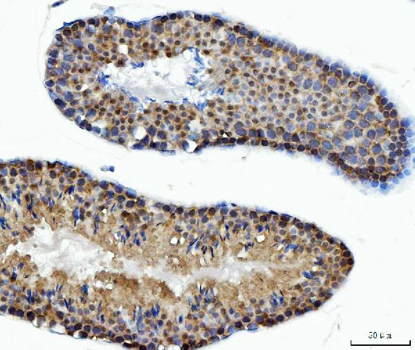 Figure 7. IHC analysis of ACLY using anti-ACLY antibody (PB10024). ACLY was detected in a paraffin-embedded section of mouse testis tissue. Heat mediated antigen retrieval was performed in EDTA buffer (pH 8.0, epitope retrieval solution). The tissue section was blocked with 10% goat serum. The tissue section was then incubated with 2 microg/ml rabbit anti-ACLY Antibody (PB10024) overnight at 4°C. Peroxidase Conjugated Goat Anti-rabbit IgG was used as secondary antibody and incubated for 30 minutes at 37°C. The tissue section was developed using HRP Conjugated Rabbit IgG Super Vision Assay Kit (Catalog # SV0002) with DAB as the chromogen.
