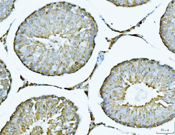 Figure 8. IHC analysis of ACLY using anti-ACLY antibody (PB10024). ACLY was detected in a paraffin-embedded section of rat testis tissue. Heat mediated antigen retrieval was performed in EDTA buffer (pH 8.0, epitope retrieval solution). The tissue section was blocked with 10% goat serum. The tissue section was then incubated with 2 microg/ml rabbit anti-ACLY Antibody (PB10024) overnight at 4°C. Peroxidase Conjugated Goat Anti-rabbit IgG was used as secondary antibody and incubated for 30 minutes at 37°C. The tissue section was developed using HRP Conjugated Rabbit IgG Super Vision Assay Kit (Catalog # SV0002) with DAB as the chromogen.