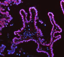 pb10031 adk primary antibodies if testing 2