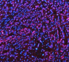pb10031 adk primary antibodies if testing 3