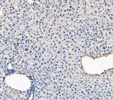 pb10031 adk primary antibodies ihc testing 5