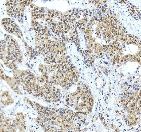 pb10031 adk primary antibodies ihc testing 6