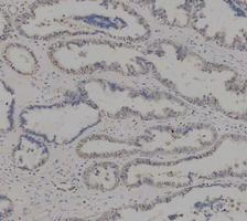 pb10031 adk primary antibodies ihc testing 7