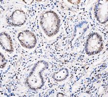 pb10031 adk primary antibodies ihc testing 8