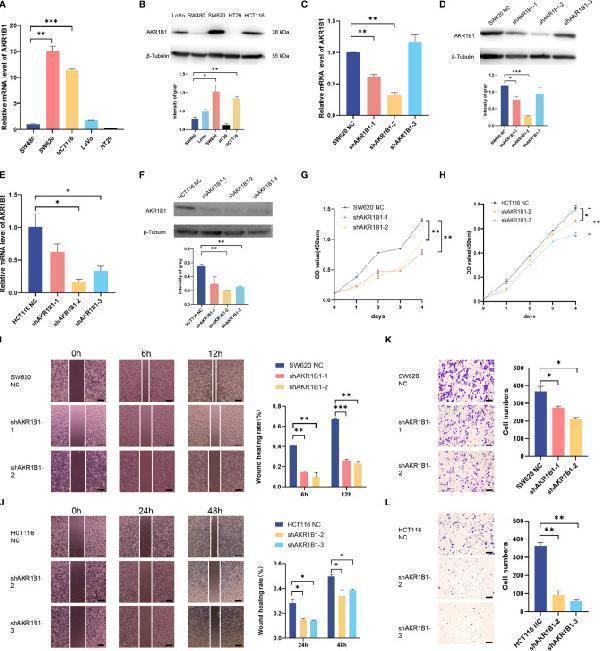 Knockdown of AKR1B1 inhibited cell proliferation, migration, and invasion