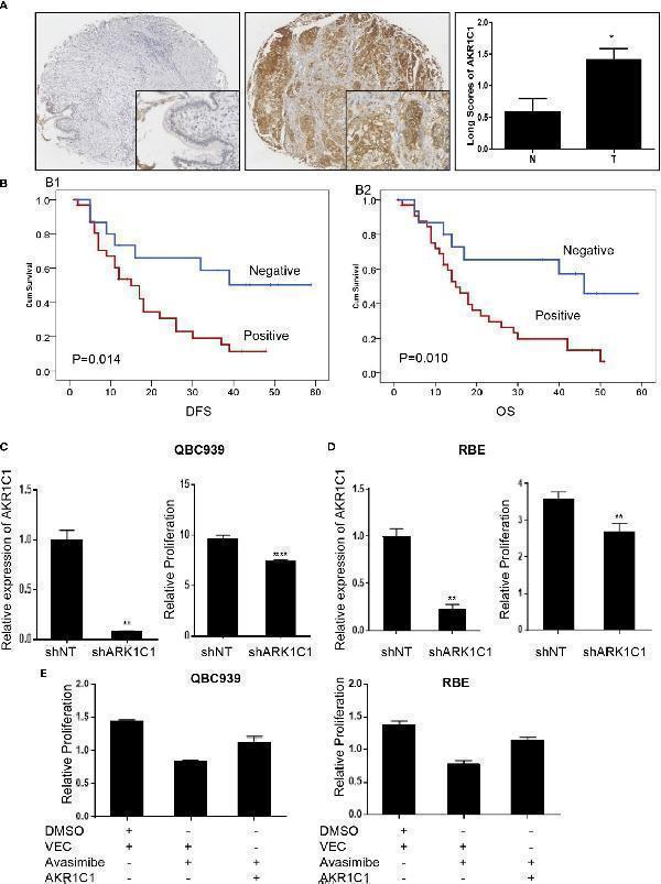 The oncogenic role of AKR1C1 in cholangiocarcinoma