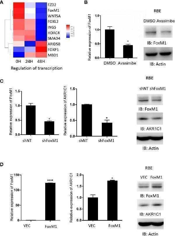 AKR1C1 is regulated by FoxM1 in cholangiocarcinoma