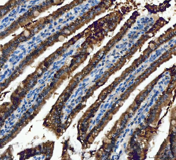 Figure 8. IHC analysis of ALDH1B1 using anti-ALDH1B1 antibody (PB10037). ALDH1B1 was detected in a paraffin-embedded section of mouse colon tissue. Heat mediated antigen retrieval was performed in EDTA buffer (pH 8.0, epitope retrieval solution). The tissue section was blocked with 10% goat serum. The tissue section was then incubated with 2 microg/ml rabbit anti-ALDH1B1 Antibody (PB10037) overnight at 4°C. Peroxidase Conjugated Goat Anti-rabbit IgG was used as secondary antibody and incubated for 30 minutes at 37°C. The tissue section was developed using HRP Conjugated Rabbit IgG Super Vision Assay Kit (Catalog # SV0002) with DAB as the chromogen.