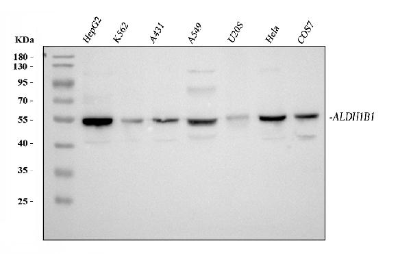 Figure 1. Western blot analysis of ALDH1B1 using anti-ALDH1B1 antibody (PB10037). Electrophoresis was performed on a 5-20% SDS-PAGE gel at 70V (Stacking gel) / 90V (Resolving gel) for 2-3 hours. The sample well of each lane was loaded with 30 ug of sample under reducing conditions. Lane 1: human HepG2 whole cell lysates, Lane 2: human K562 whole cell lysates, Lane 3: human A431 whole cell lysates, Lane 4: human A549 whole cell lysates, Lane 5: human U20S whole cell lysates, Lane 6: human Hela whole cell lysates, Lane 7: monkey COS-7 whole cell lysates. red to a nitrocellulose membrane at 150 mA for 50-90 minutes. Blocked the membrane with 5% non-fat milk/TBS for 1.5 hour at RT. The membrane was incubated with rabbit anti-ALDH1B1 antigen affinity purified polyclonal antibody (Catalog # PB10037) at 0.5 microg/mL overnight at 4°C, then washed with TBS-0.1%Tween 3 times with 5 minutes each and probed with a goat anti-rabbit IgG-HRP secondary antibody at a dilution of 1:5000 for 1.5 hour at RT. The signal is developed using an Enhanced Chemiluminescent detection (ECL) kit (Catalog # EK1002) with Tanon 5200 system. A specific band was detected for ALDH1B1 at approximately 55 kDa. The expected band size for ALDH1B1 is at 57 kDa.