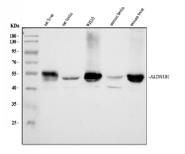 Figure 2. Western blot analysis of ALDH1B1 using anti-ALDH1B1 antibody (PB10037). Electrophoresis was performed on a 5-20% SDS-PAGE gel at 70V (Stacking gel) / 90V (Resolving gel) for 2-3 hours. The sample well of each lane was loaded with 30 ug of sample under reducing conditions. Lane 1: rat liver tissue lysates, Lane 2: rat testis tissue lysates, Lane 3: rat RH35 whole cell lysates, Lane 4: mouse brain tissue lysates, Lane 5: mouse liver tissue lysates. red to a nitrocellulose membrane at 150 mA for 50-90 minutes. Blocked the membrane with 5% non-fat milk/TBS for 1.5 hour at RT. The membrane was incubated with rabbit anti-ALDH1B1 antigen affinity purified polyclonal antibody (Catalog # PB10037) at 0.5 microg/mL overnight at 4°C, then washed with TBS-0.1%Tween 3 times with 5 minutes each and probed with a goat anti-rabbit IgG-HRP secondary antibody at a dilution of 1:5000 for 1.5 hour at RT. The signal is developed using an Enhanced Chemiluminescent detection (ECL) kit (Catalog # EK1002) with Tanon 5200 system. A specific band was detected for ALDH1B1 at approximately 55 kDa. The expected band size for ALDH1B1 is at 57 kDa.