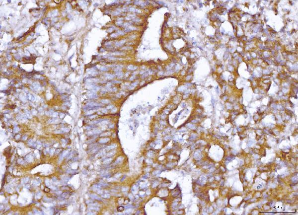 pb10040 aoc1 primary antibodies ihc testing 2