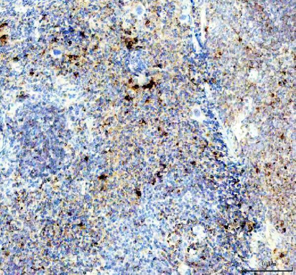 pb10058 ela2 primary antibodies ihc testing 2
